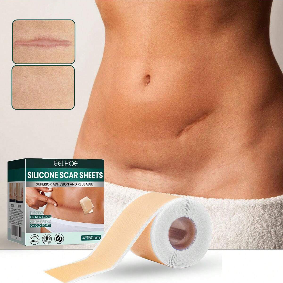 شرائح سيليكون طبية للندبات – شريط سيليكون لإزالة آثار الجروح والعمليات (4 سم × 150 سم)